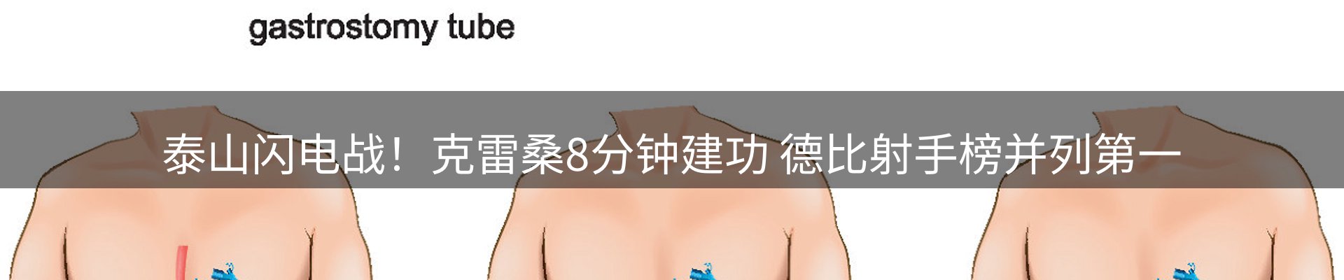 体育资讯